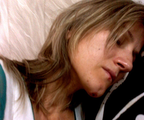 Сапият Магомедова после избиения. Фото предоставлено Правозащитным центром "Мемориал"
