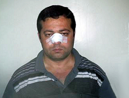 Корреспондент азербайджанской службы "Радио Свобода" Эльчин Исмаил, подвергшийся нападению во время работы в селе Буйнуз 26 мая 2014 г. Фото: Радио Азадлыг (RFE/RL), www.radioazadlyg.org