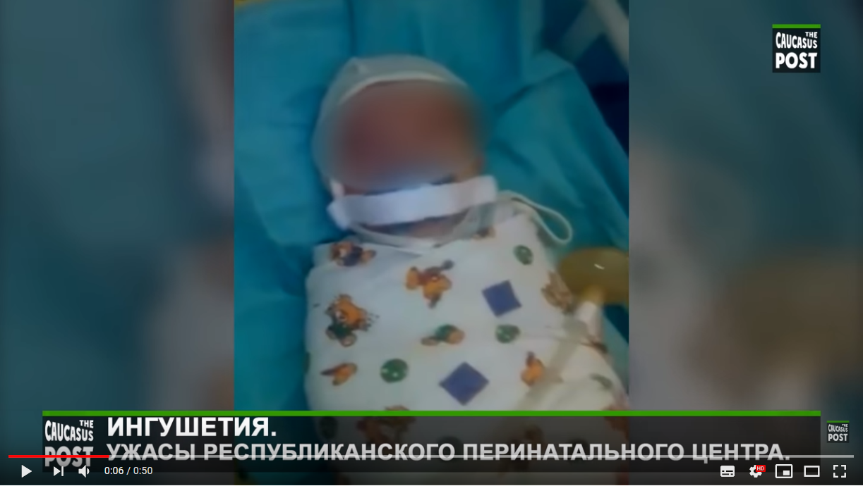 Кадр видео из перинатального центра Назрани. The Caucasus post. https://www.youtube.com/watch?time_continue=3&v=nmR71g8sHYs