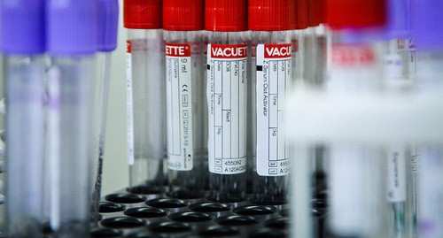 Медицинские пробирки. Фото: © Елена Синеок, ЮГА.ру
