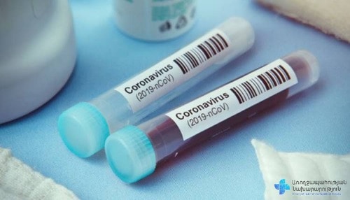 Анализ крови на COVID-19. Фото пресс-службы Минздрава Армении. https://www.facebook.com/ministryofhealthcare/ Анализ крови на COVID-19. Фото пресс-службы Минздрава Армении. https://www.facebook.com/ministryofhealthcare/