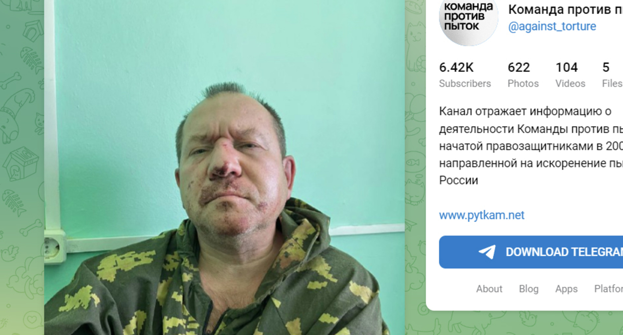 Игорь Каляпин в больнице. Фото https://t.me/s/against_torture/2203 Игорь Каляпин в больнице. Фото https://t.me/s/against_torture/2203