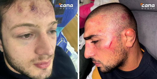 Избитые в Цхинвале молодые люди. Скриншот фото "Сапа Цхинвал" от 20.10.25, https://t.me/sapa_tskhinval/3019