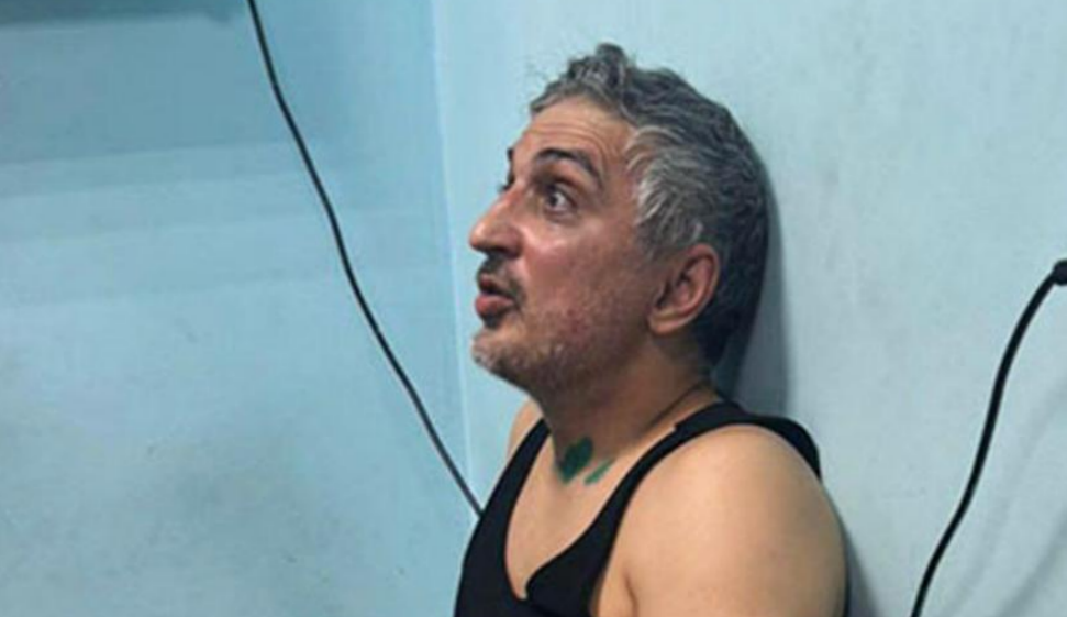 Заур Кайтуев после избиения. Фото предоставлено "Кавказскому узлу".